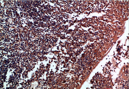 Tenascin-R Polyclonal Antibody