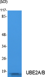 UBE2A/B Polyclonal Antibody