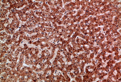 ANG I Polyclonal Antibody