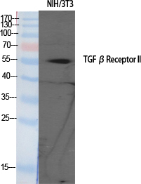 TGFβ RII Polyclonal Antibody