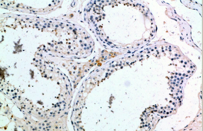 PMCH Polyclonal Antibody