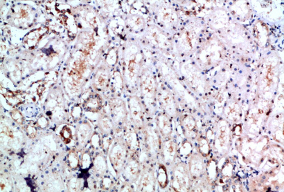 DLEU7 Polyclonal Antibody