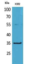 CD32-A Polyclonal Antibody