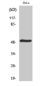 TdT Polyclonal Antibody