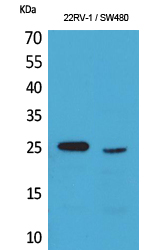 SSX Polyclonal Antibody