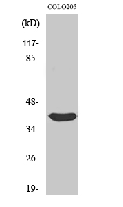 Siah-2 Polyclonal Antibody