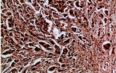 HDGF Polyclonal Antibody