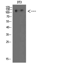 Hamartin Polyclonal Antibody