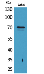 Prothrombin Polyclonal Antibody