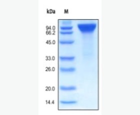 Recombinant Human LAMP1/CD107a