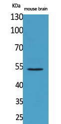 CPE Polyclonal Antibody