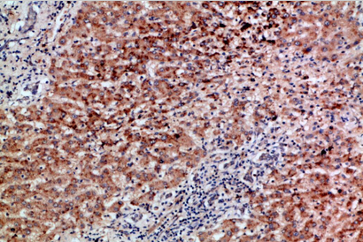 BMP-9 Polyclonal Antibody