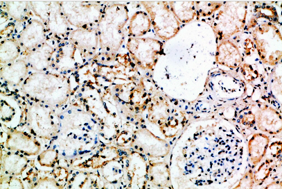 CD16 Polyclonal Antibody