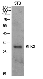 PSA Polyclonal Antibody