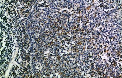 CD274 Polyclonal Antibody