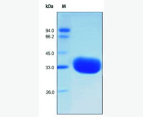 Recombinant Human C-X-C Motif Chemokine 12/CXCL12/SDF-1