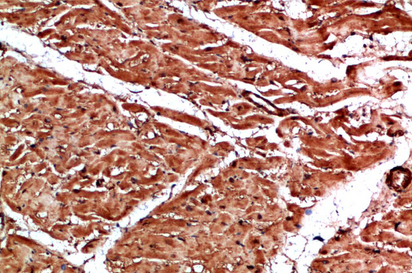 TTN Polyclonal Antibody