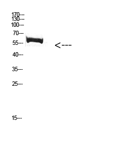 FBXO7 Polyclonal Antibody