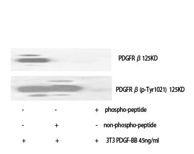 PDGFR-β Polyclonal Antibody