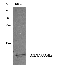 MIP-1b Polyclonal Antibody