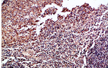 GM-CSF Polyclonal Antibody