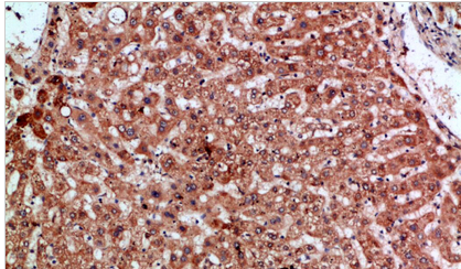 MIP-3α Polyclonal Antibody