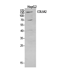 COL5A2 Polyclonal Antibody