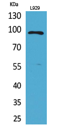 MACC1 Polyclonal Antibody