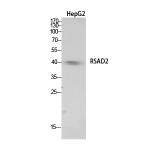 RSAD2 Polyclonal Antibody