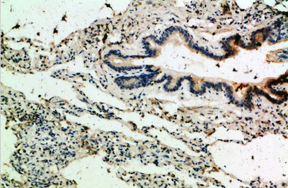 Thrombospondin 4 Polyclonal Antibody