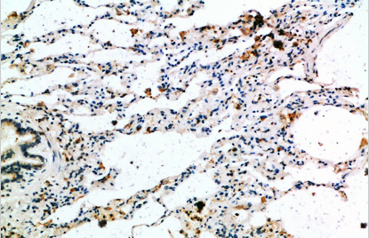 GROα Polyclonal Antibody