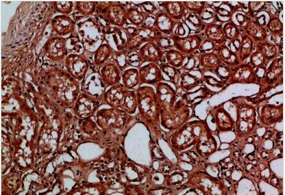 EYA1/EYA4 Polyclonal Antibody