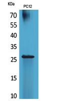 POLR3G Polyclonal Antibody