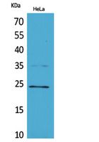 Rab 5A Polyclonal Antibody