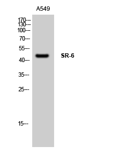 SR-6 Polyclonal Antibody