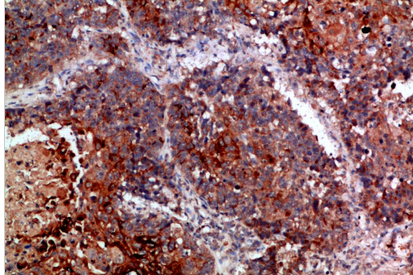 MLL Polyclonal Antibody