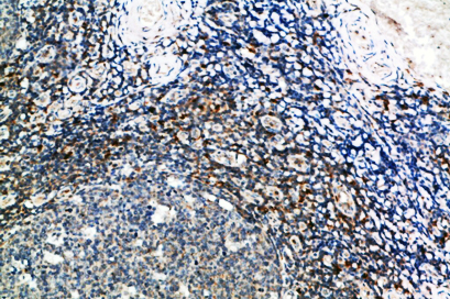 GSC Polyclonal Antibody