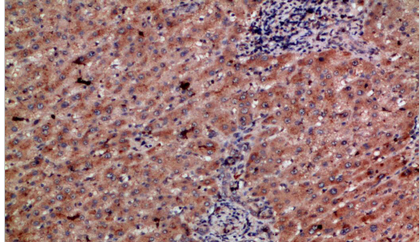 CD303 Polyclonal Antibody