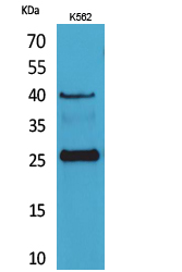 CD161 Polyclonal Antibody