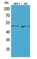 PD-ECGF Polyclonal Antibody