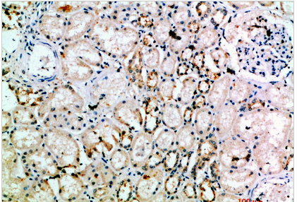 NCAM-L1 Polyclonal Antibody