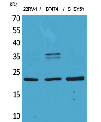 FGF-12 Polyclonal Antibody