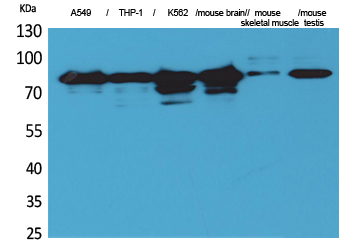 PKC γ Polyclonal Antibody