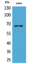 ERα Polyclonal Antibody