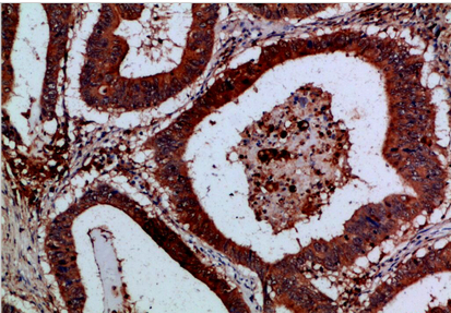 Cystatin B Polyclonal Antibody