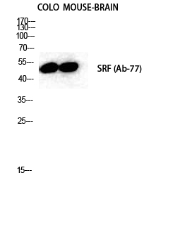 SRF Polyclonal Antibody