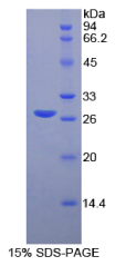 Recombinant Matrix Metalloproteinase 2 (MMP2)