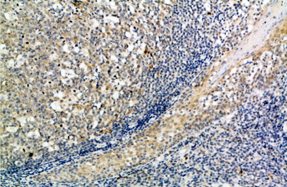 ATG10 Polyclonal Antibody