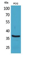 BST-1 Polyclonal Antibody