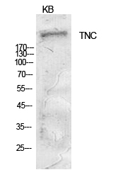 Tenascin-C Polyclonal Antibody